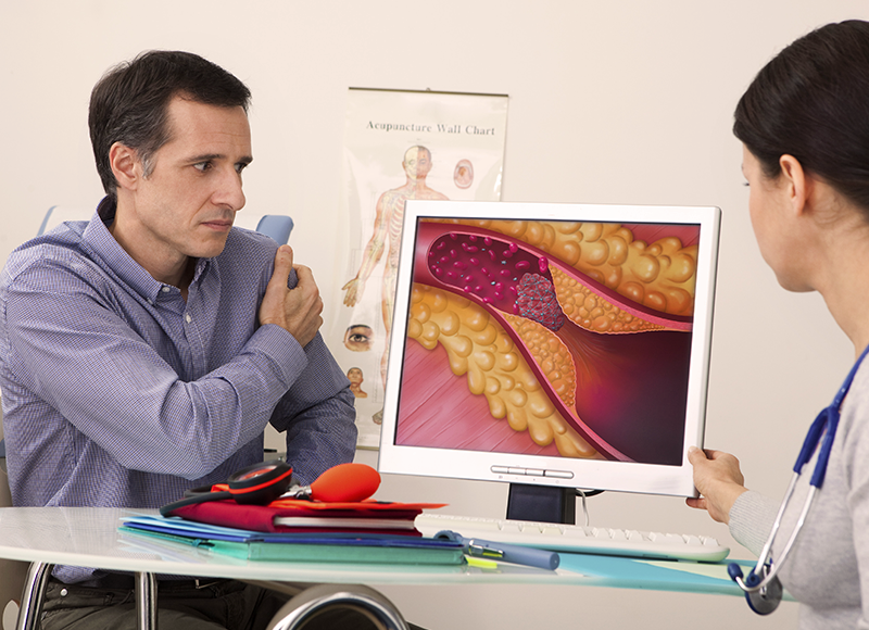 Coronary Artery Disease