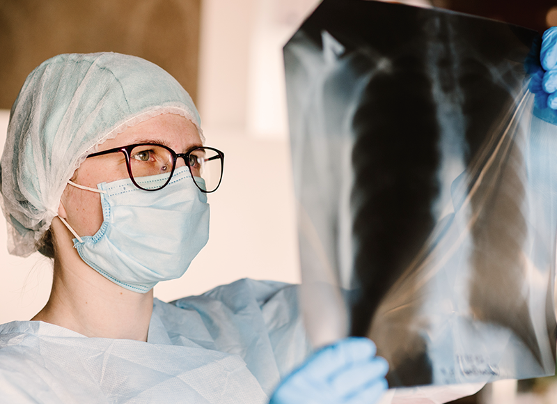 Pulmonary Hypertension