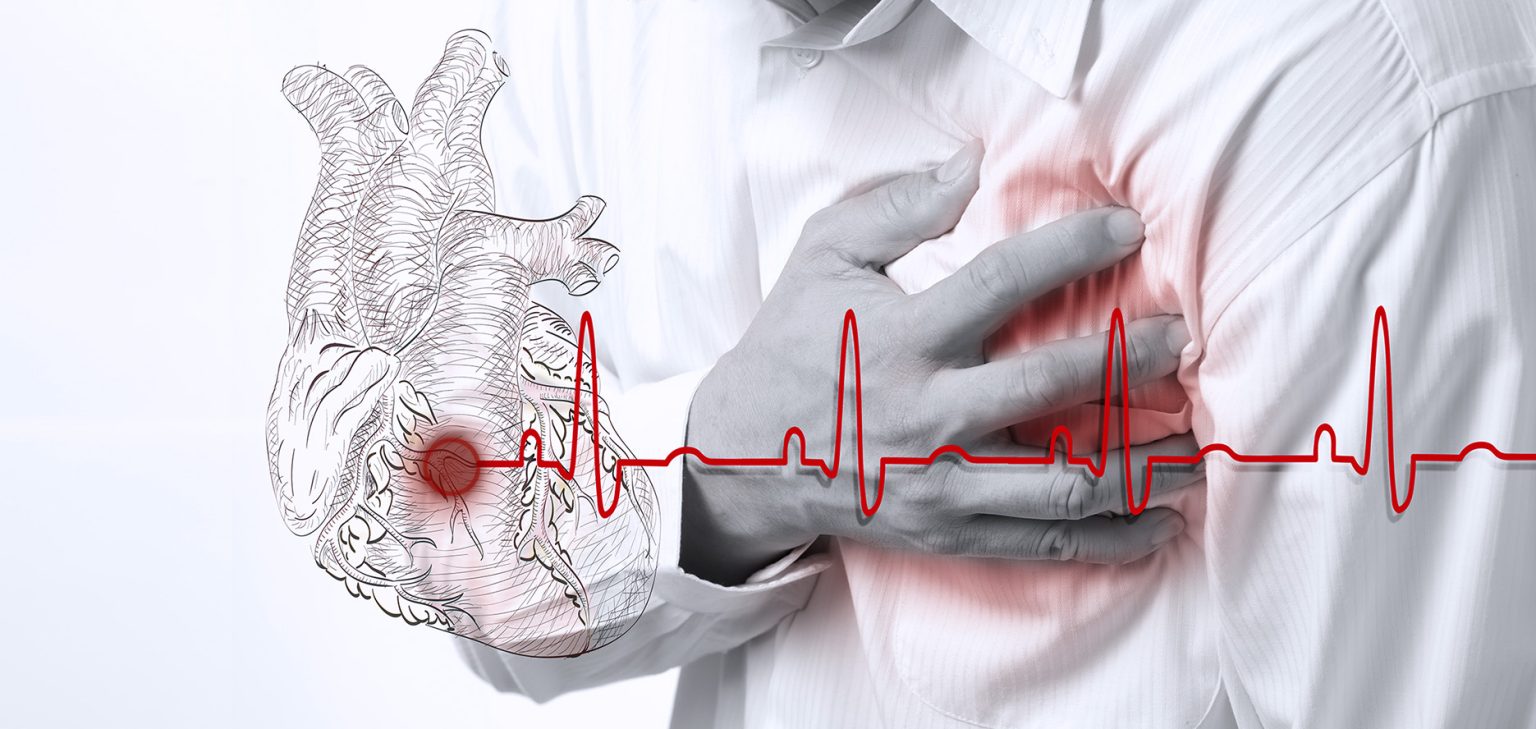 The Top Daily Measures For Preventing Cardiovascular Diseases How To Prevent Cardiovascular Diseases Effectively