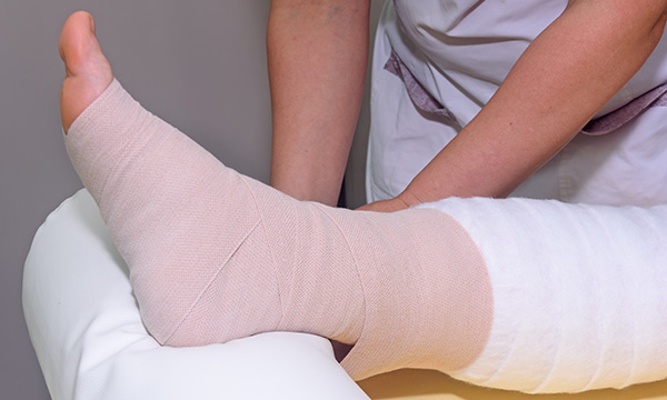 Treatment Options for CVI