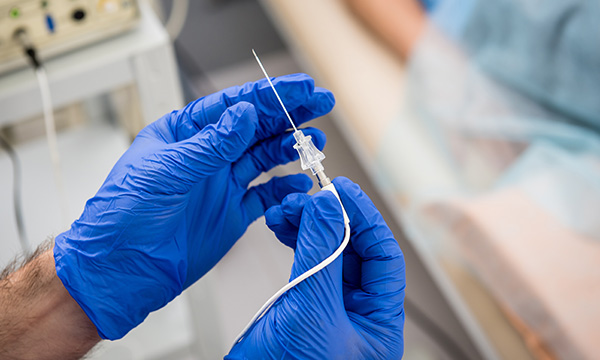 Radiofrequency Ablation