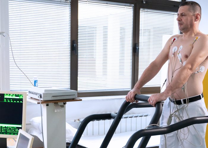 Cardiac Stress Test: What It Can Tell You and What It Cannot