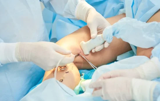 Radio Frequency Ablation