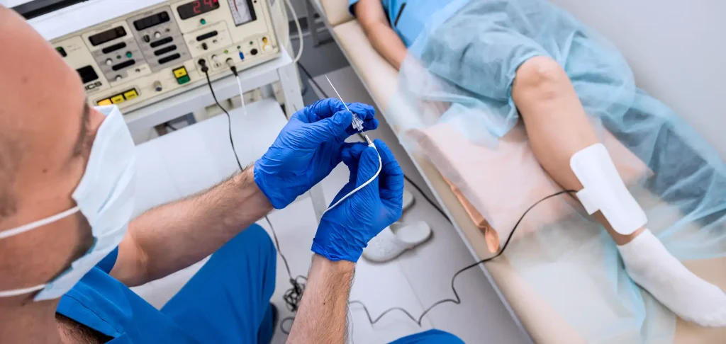 Why RFA treatment for varicose veins stands out