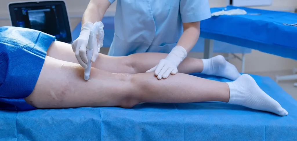 When to Visit a Varicose Vein Clinic