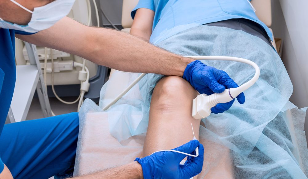 6 FAQs Patients Ask About Radiofrequency Ablation (RFA) Treatment