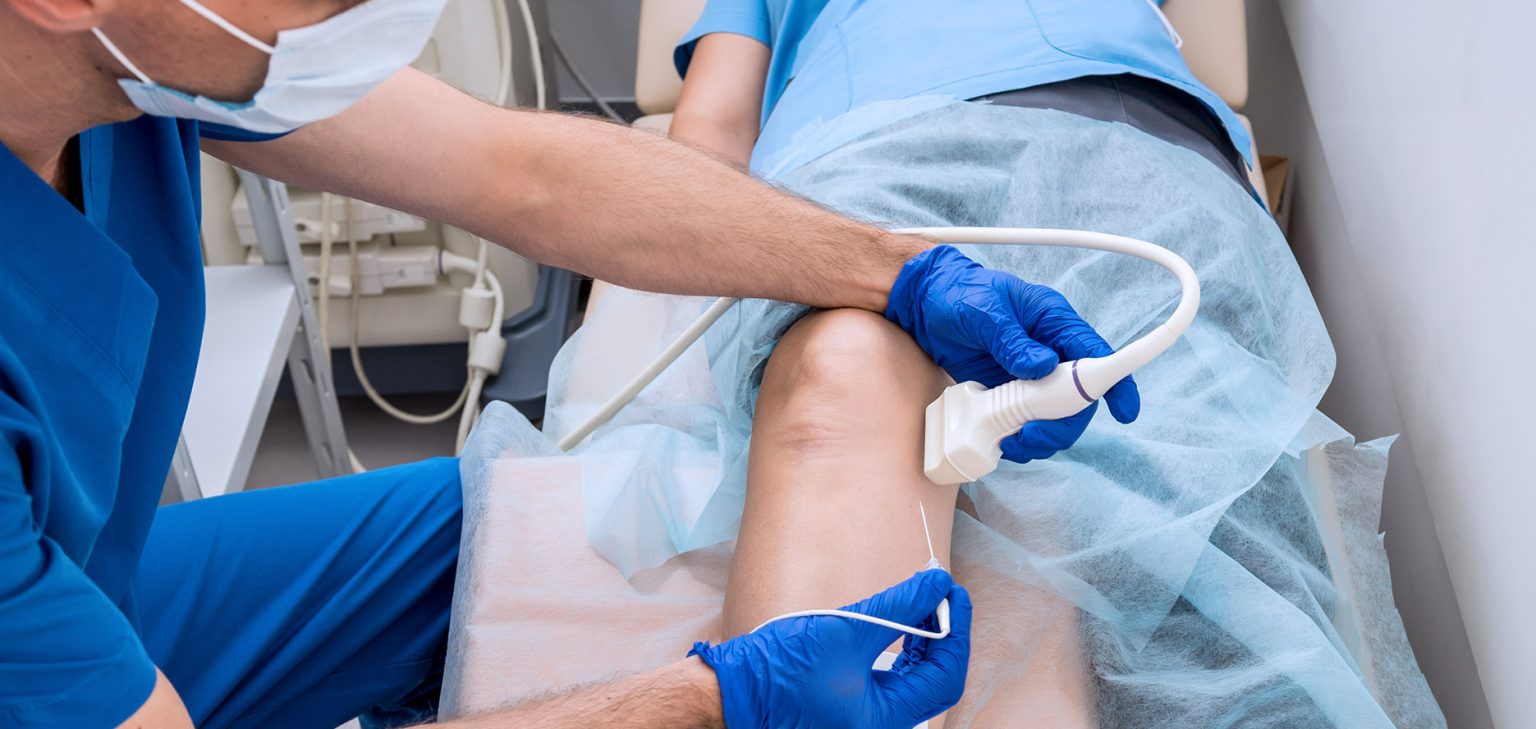 RFA Therapy – FAQs | Advanced Cardiovascular Center