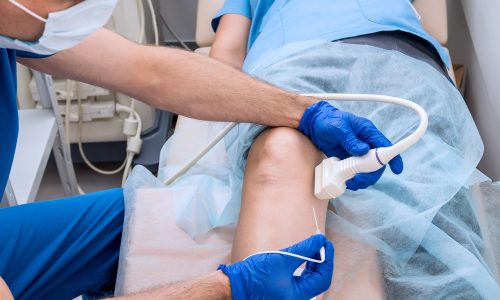 6 FAQs Patients Ask About Radiofrequency Ablation (RFA) Treatment