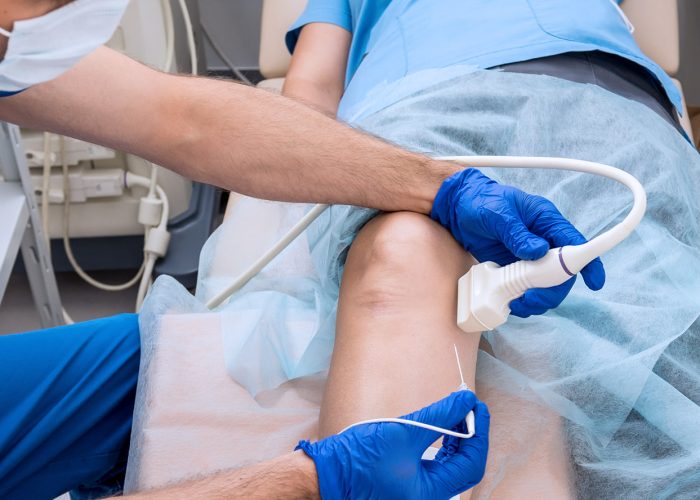 6 FAQs Patients Ask About Radiofrequency Ablation (RFA) Treatment