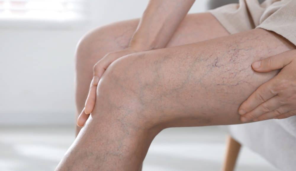 Myths and Facts About PAD: What September’s Awareness Month Wants You to Know